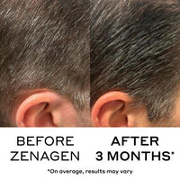 Zenagen Eclipse Travel Pack